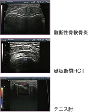 超音波診断の例
